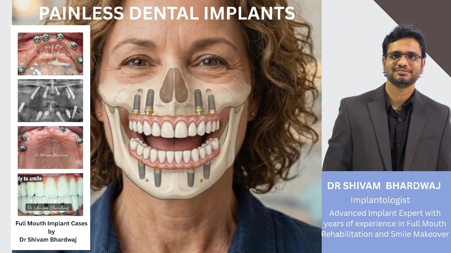 A New Era in Dental Implants: How Dr. Shivam Bhardwaj is Changing Dentistry in Gurugram